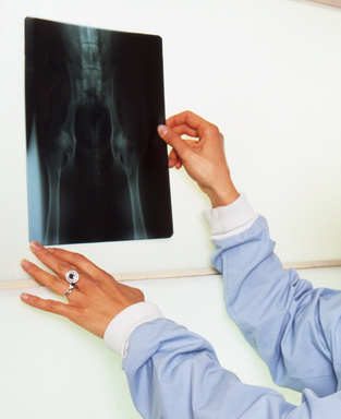 radiographie  de la hanche sur un chien- dysplasie