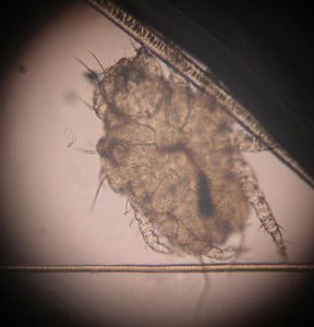 Parasite Cheyletiella observé au microscope-troubles cutanés