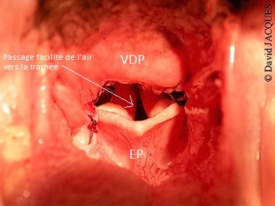 resultat operation trachee-syndrome brachycephale