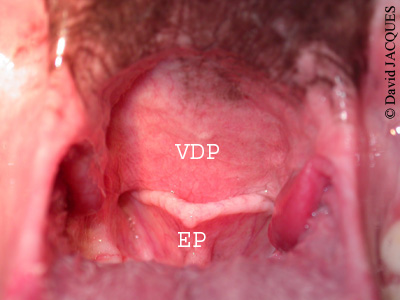 Fond de gorge chien-syndrome brachycephale