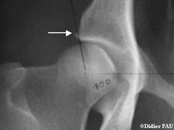 hanche-chien-radiologie-dysplasie-moyenne