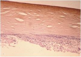 coupe microscope - sequestre corneen felin