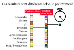 Lire la suite à propos de l’article Intérêt de l’analyse des urines dans le diagnostic des infections du tractus urinaire