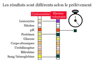 Lire la suite à propos de l’article Intérêt de l’analyse des urines dans le diagnostic des infections du tractus urinaire