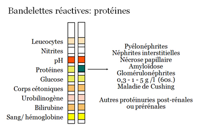 Ammoniaque - Analyse sanguine et urinaire – Interprétation des