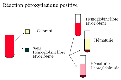 Intérêt de l'analyse des urines dans le diagnostic des infections ...