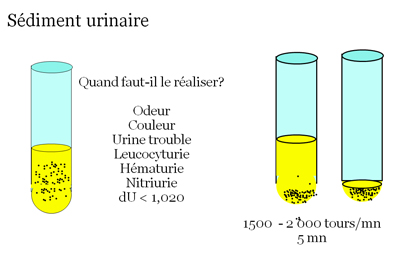 Intérêt de l'analyse des urines dans le diagnostic des infections ...