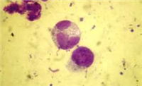 Eosinophile de chat au microscope