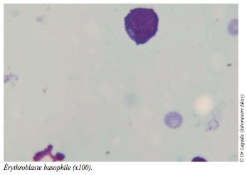 vue microscope cellules - anemie