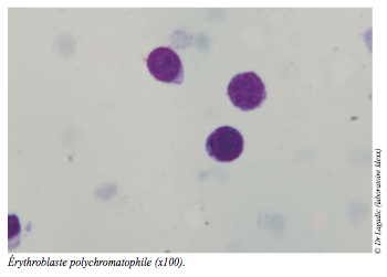 vue microscope cellules - anemie