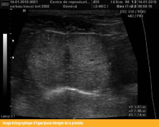 hypertrophie prostate chien symptomes