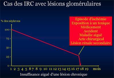 graphique-insuffisance renale