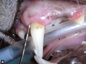 examen insertion sonde gencive - maladie parodontale