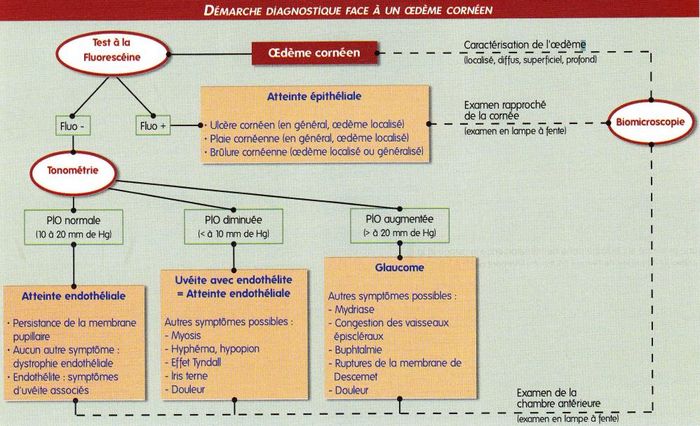 tableau diagnostique - œdeme corneen