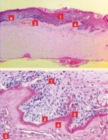 vue microscope - ulcere superficiel chronique cornee chien