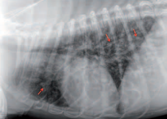 radio thorax - angiostrongylose