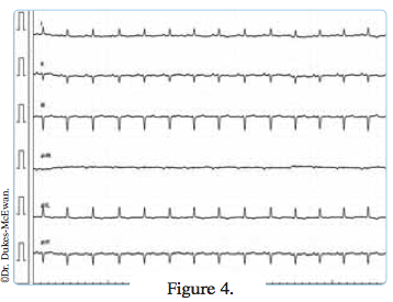 electrocardiogramme chat age - arythmies cardiaques