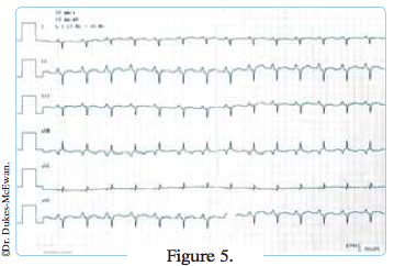 electrocardiogramme chat insuffisant cardiaque -