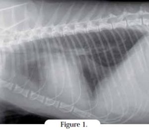 radio cage thoracique - cardiomyopathie restrictive