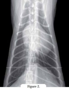 radio thoracique laterale - cardiomyopathie restrictive