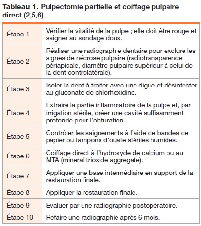 tableau etapes pulpectomie - dentisterie jeunes chats chiens