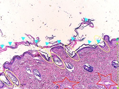 vue microscopique epiderme - ichtyose golden retriever