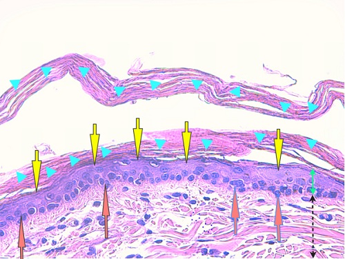 vue microscopique epiderme - ichtyose golden retriever