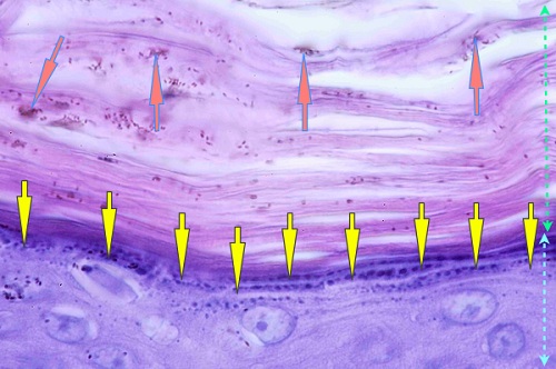 vue microscopique epiderme - ichtyose golden retriever