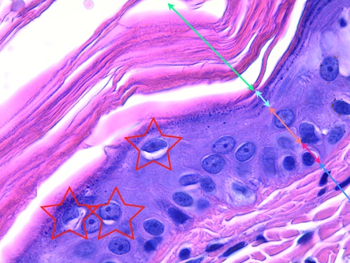 vue microscopique epiderme - ichtyose golden retriever