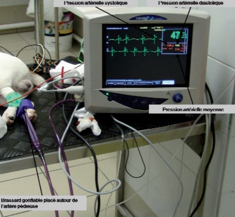 oscillometre - mesure pression arterielle