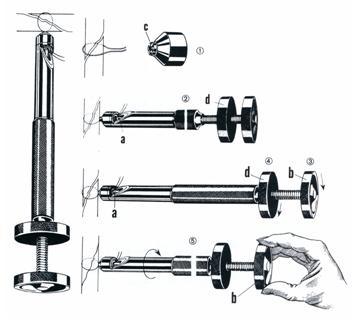 croquis cercleur de loute - osteosynthese