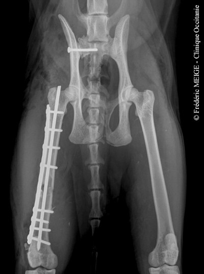 radio-hanche - osteosynthese