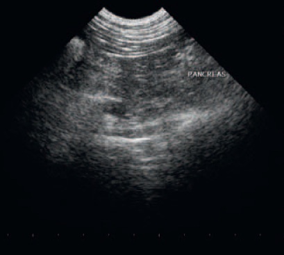 echographie abdominale - pancreatite chien