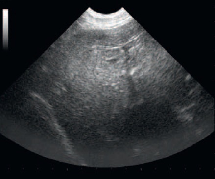 echographie abdominale - pancreatite chien