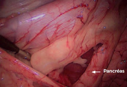 pancreas - pancreatite chien