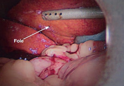 foie - pancreatite chien