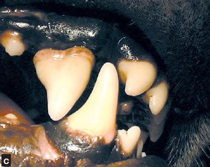 prothese ceramique - traumatismes dentaires