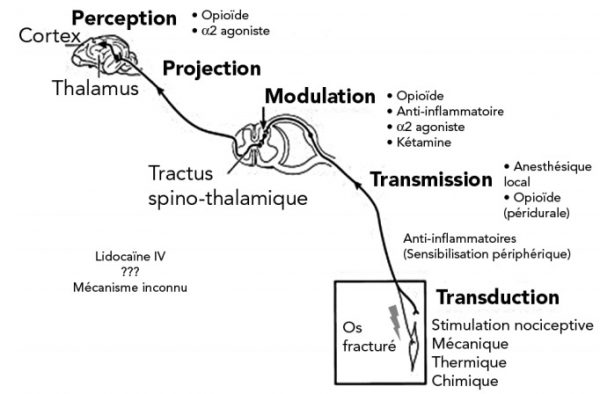 schema protocole analgesie multimodale - douleur aigue chien chat