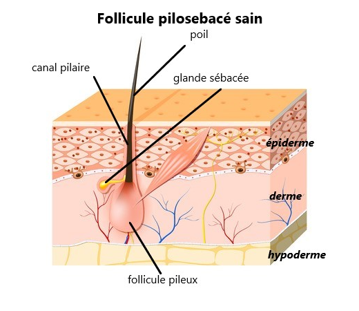 L Acne Du Chat Vetopedia