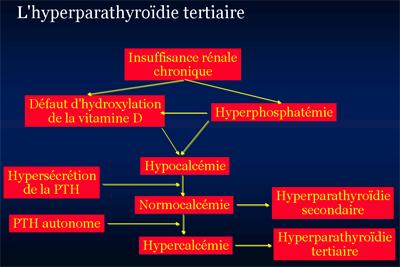 tableau explicatif - hyperparathyroidie tertiaire