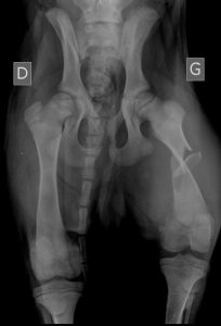 radiographie femur - ostéosynthèse élastique