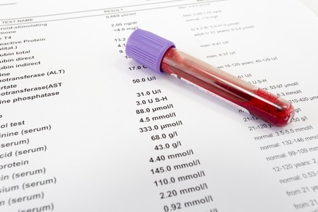 éprouvette prélèvement sanguin posée sur compte rendu analyse de sang