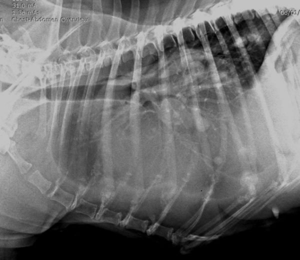 radio du thorax de profil cinq mois apres intervention suite chondrosarcome