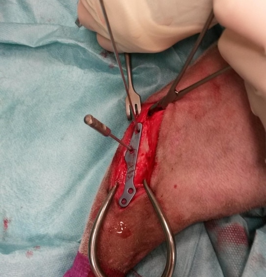 plaque metal fixée sur os par chirurgien avec materiel chirurgicalsuite tibial tuberosity advancement