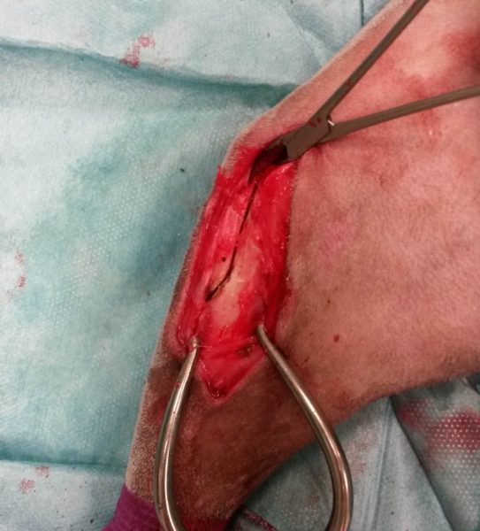 osteotomie du tibia après la découpe de la zone concernee suite tibial tuberosity advancement