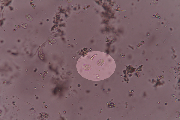 Kystes de Giardia observés au microscope
