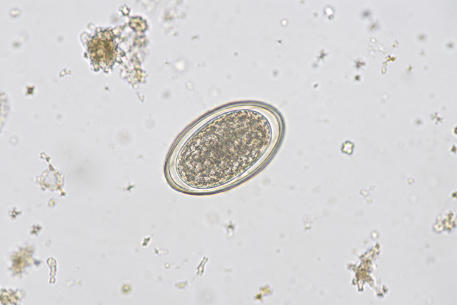 Œuf de strongle vu au microscope lors d'une coproscopie pour décider de la vermifugation du cheval
